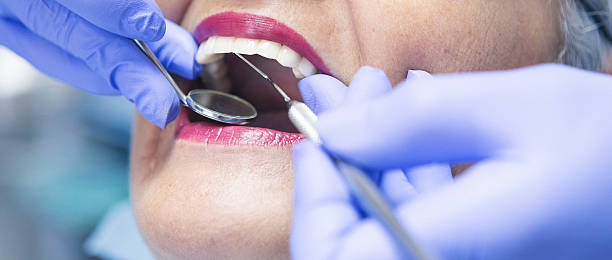 Best Emergency Tooth Extraction in Stevenson, WA